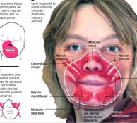 The evolution of the first face transplant